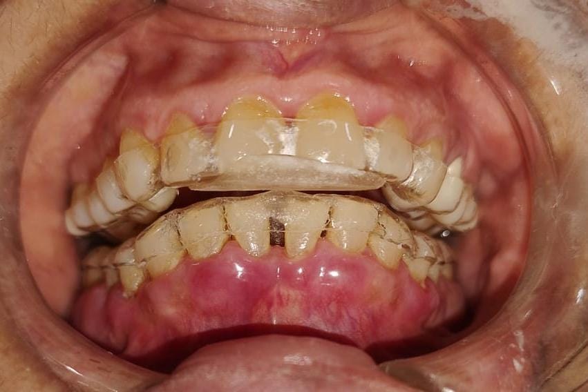 DAASA case